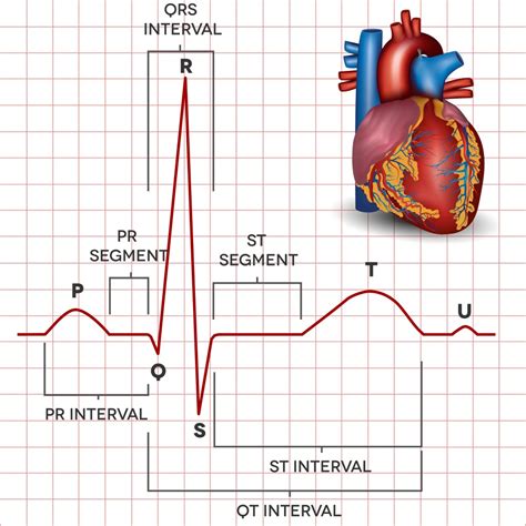 ECG